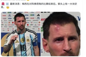 一場苦戰(zhàn)！梅西賽后額頭上有一大塊淤青